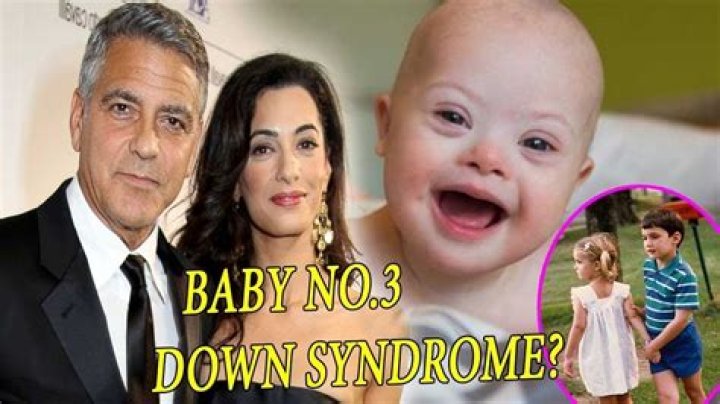 George Clooney's Inspiring Journey With Children Facing Down Syndrome