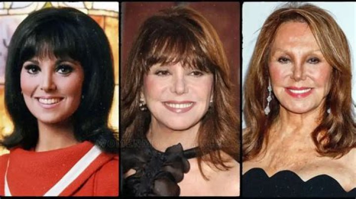 Marlo Thomas On Botox: The Surprising Benefits And Risks