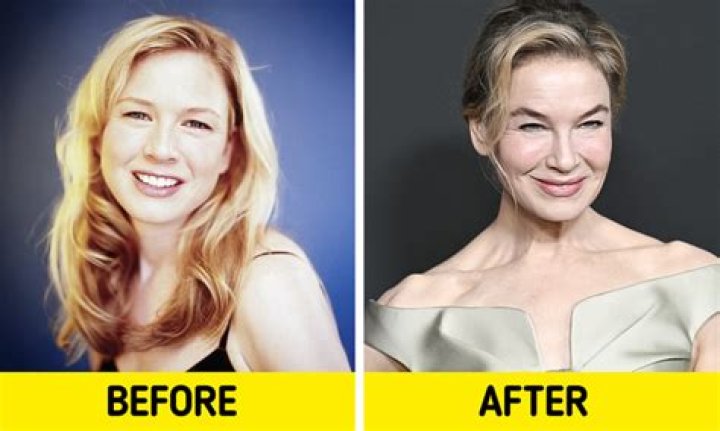 Renee Zellweger's Transformation: A Then And Now Photo Comparison