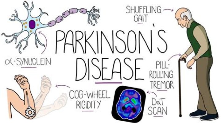 Richard Dreyfuss's Parkinson's: Symptoms, Diagnosis, And Treatment