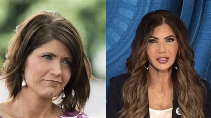 Surprising Transformation: Before And After Photos Reveal Kristi Noem's Plastic Surgery Journey