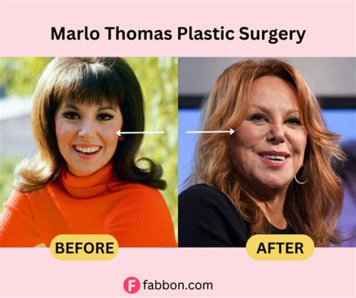 The Scoop On Marlo Thomas's Facelift: Fact Or Fiction?