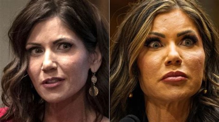 The Truth About Kirstie Noem's Plastic Surgery Rumors