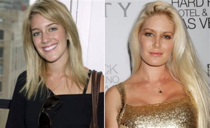 Unrecognizable! The Startling Transformation Of Heidi Montag Before And After